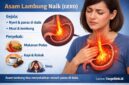 Asam lambung bisa menyebabkan sensasi panas di dada jika tidak ditangani.