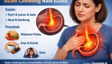 Asam lambung bisa menyebabkan sensasi panas di dada jika tidak ditangani.