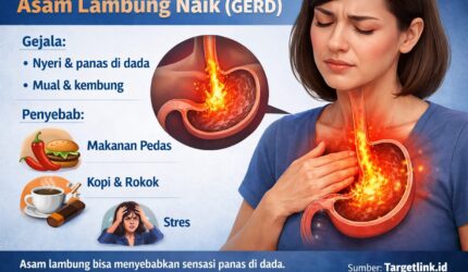Ilustrasi asam lambung naik ke kerongkongan, menunjukkan rasa panas di dada.