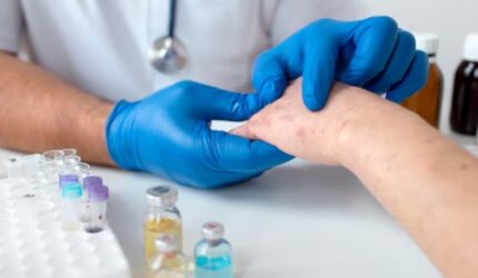 Ilustrasi anak mendapatkan vaksin campak untuk mencegah penyakit menular