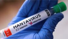 Kementerian Kesehatan RI mengimbau masyarakat meningkatkan kewaspadaan terhadap hantavirus yang ditularkan melalui tikus dan lingkungan terkontaminasi.