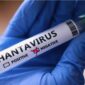 Kementerian Kesehatan RI mengimbau masyarakat meningkatkan kewaspadaan terhadap hantavirus yang ditularkan melalui tikus dan lingkungan terkontaminasi.